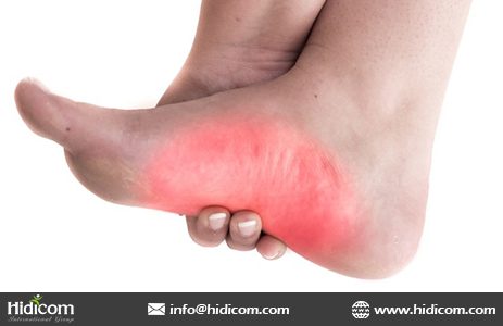 how painful is gout